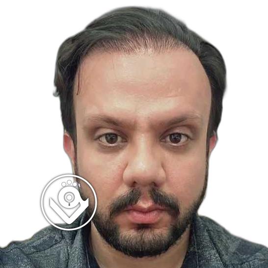 تصویر پروفایل مصطفی کریمی - دکتر در قم
